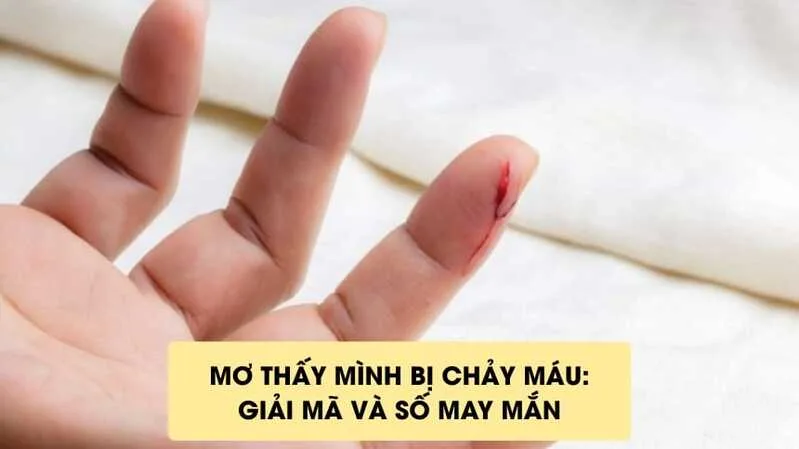 Mơ thấy chính mình chảy máu có thể phản ánh cảm giác mất sức, tổn thương hoặc áp lực cá nhân.