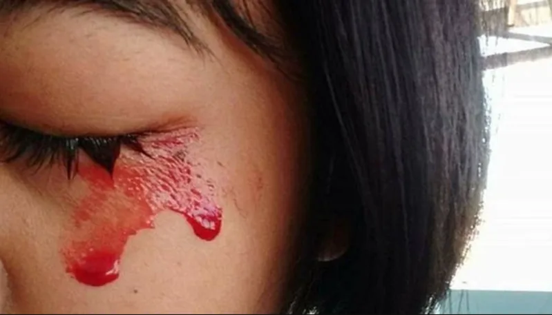 Máu trên mặt có thể phản ánh sự nhạy cảm với ánh nhìn của người khác hoặc cảm xúc bị tổn thương.